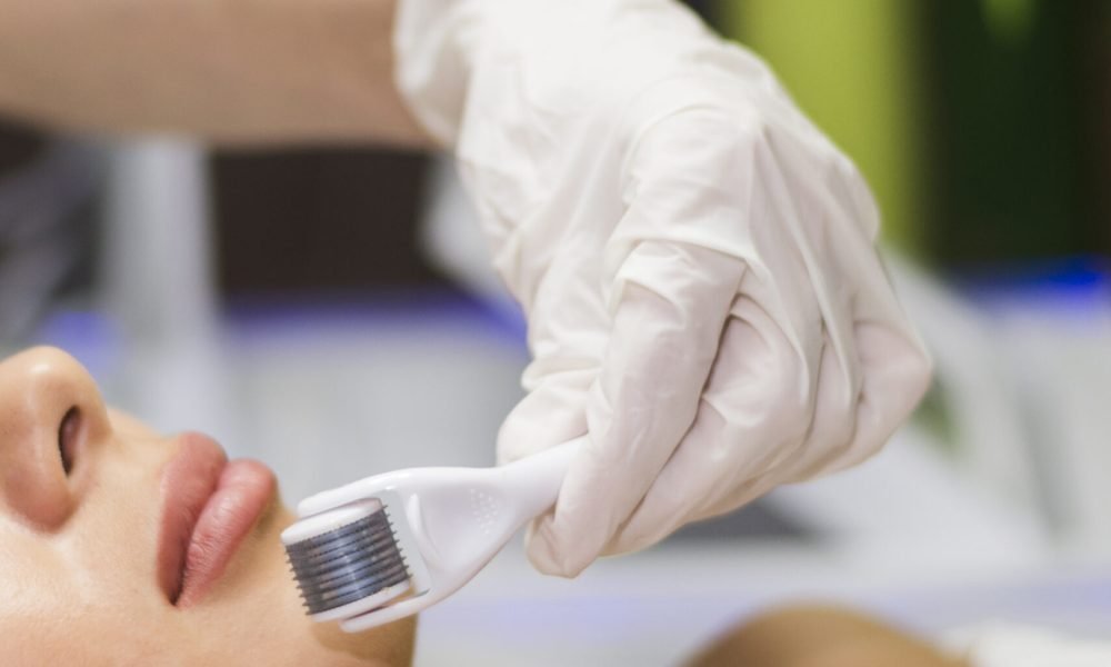 Benefícios, Especialista, Clinica, Tratamento de pele, Microagulhamento estético, Facial, Curitiba e Região Metropolitânia